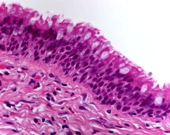 Ученые из Китая: риск острых почечных болезней растет из-за COVID-19