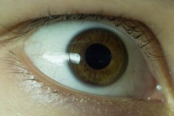 Врач Коновалов запретил купаться в контактных линзах