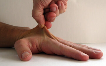 Невролог Джикия: хруст пальцами изнашивает суставы