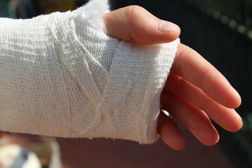 Ортопед Саутин: крестообразные связки и кисти рук часто травмируются у спортсменов