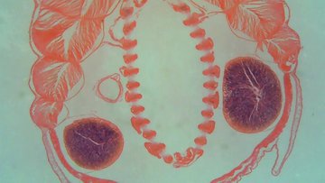 Лор Алиев: при увеличении миндалин ребенок храпит