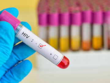 Врачи сообщили о третьем излеченном от ВИЧ пациенте