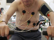 Гипертония: «Молчаливый убийца» уничтожает людей. Видео