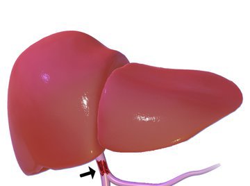 Ученые из Испании: пемафибрат может вылечить неалкогольную жировую болезнь печени