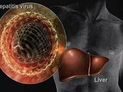 Больные гепатитом: вирус растет, как и где хочет