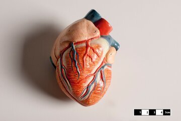 Терапевт Данилкина: дискомфорт в груди указывает на инфаркт