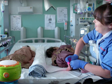 Британские врачи разделили сиамских близнецов со сросшимися головами