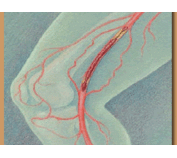 В России отметили первый Всемирный день тромбоза