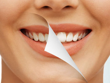 Стоит ли отбеливать зубы - плюсы и минусы процедуры