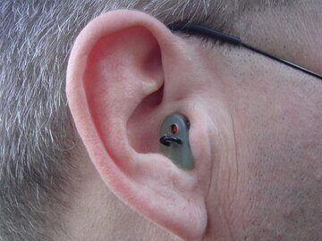 Cureus: ожирение провоцирует шум в ушах