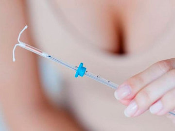 Внутриматочные средства контрацепции: за и против