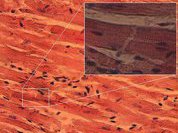 Для чего перепрограммировать сердечные  клетки?