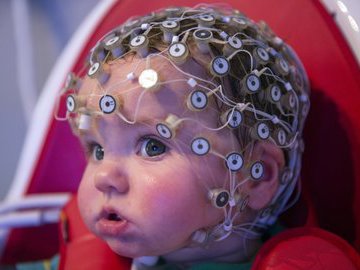 Способы выявления болезней мозга у детей