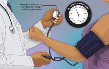 Hypertension: хроническая боль вызывает гипертонию