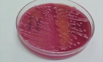Nature: кишечная палочка E. coli может привести к раку кишечника