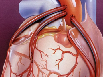Открытия, положившие конец сердечным приступам. Часть 2