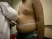 Как распознать у себя пищевое расстройство