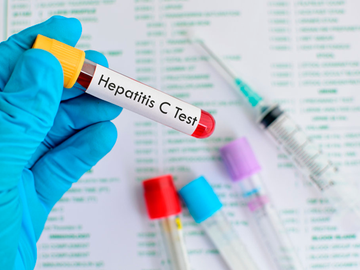 Французские исследователи выяснили, как снизить риск последствий гепатита C
