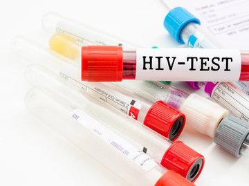Ученым удалось создать одновременный экспресс-тест на ВИЧ и туберкулез