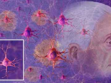 Открытие: нервные клетки восстанавливаются даже после 80 лет