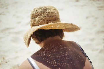 Дерматолог Егорова: защитить волосы от воздействия солнца можно спреем