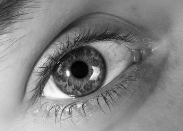 Хирург Умнов: синяки под глазами появляются при болезни печени