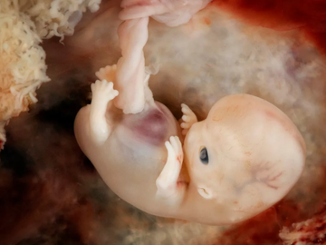 В человеческом эмбрионе обнаружены ранее неизвестные атавизмы