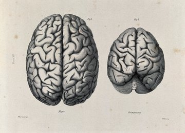 Врач Пикетт: лекарства от аллергии могут привести к деменции