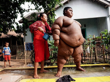 Мальчик из Индонезии похудел на 100 килограммов