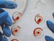 Свертываемость крови поставили на контроль