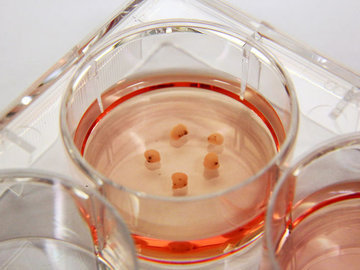 Ученые научились выращивать человеческие микроорганы в чашке Петри