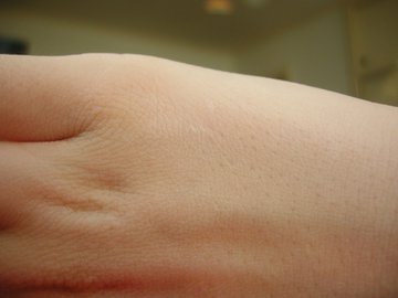 Врач Щепеляев: сбой в иммунитете провоцирует высыпания на коже