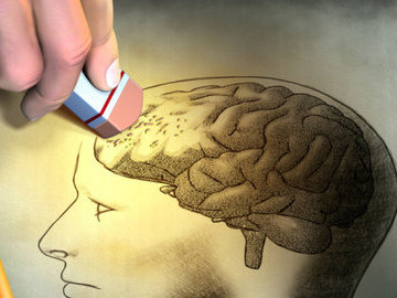 Депрессия после 20 лет приводит к потерям памяти после 50