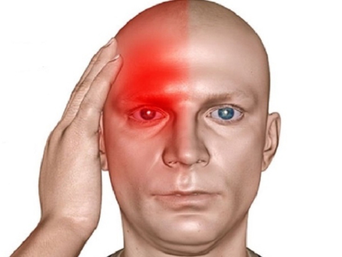 Что такое глазная мигрень