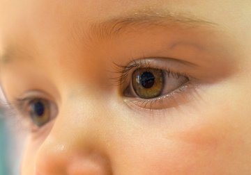 Миргородская: ощущение «песка в глазах» появляется при конъюнктивите