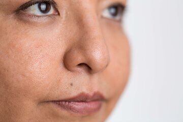 Врач Артищев: ковыряние в носу доведет до травмы хряща