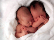Женщина родила близнецов от двух разных мужчин
