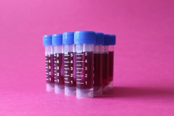 Врач Тен: рак крови вызывает повышение тромбоцитов