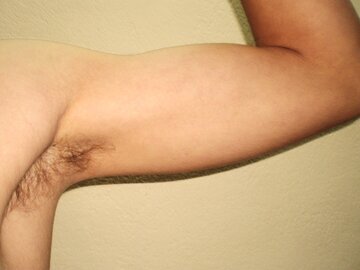 Врач Лебедева: антиперспиранты закупоривают потовые железы