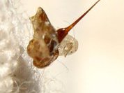 Ударим по ВИЧ пчелиным ядом!