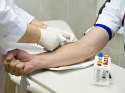 Переходим на закрытые системы взятия крови