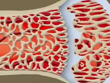 Открытие: кости в организме растут сами по себе