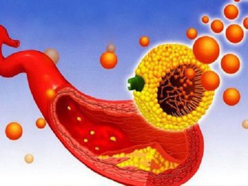 "Хороший" холестерин: когда его становится слишком много