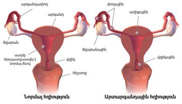 Уролог Низин: кофе и грелки внизу живота противопоказаны при цистите