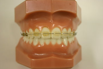 Врач Бороздкин: неправильный прикус может привести к остеохондрозу