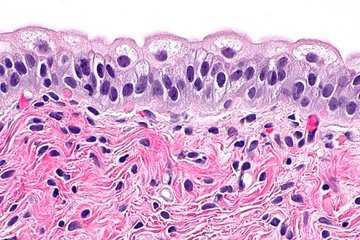 Врач Гандельман: рак простаты определяется анализом на ПСА