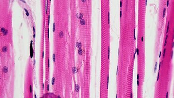 Врач Шах: невылеченный цистит способен повредить почки