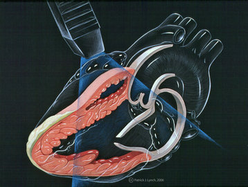 Хирург Балдин: сохранить здоровье сердца поможет снижение уровня стресса