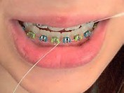 Зубы: еще одна причина для боли