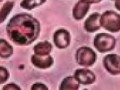 Артрит будут лечить клетками крови?